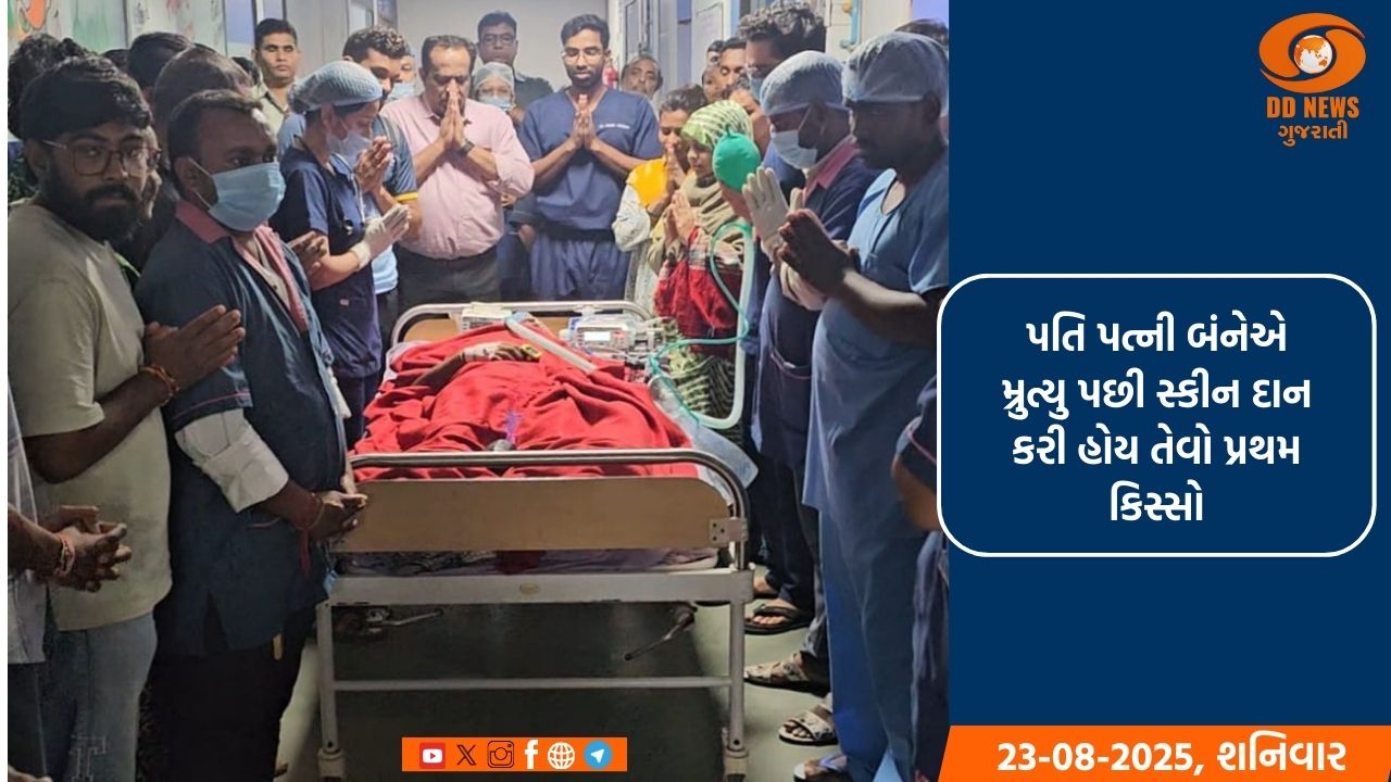 સિવિલ હોસ્પિટલને મળ્યું 23મું સ્કિન ડોનેશન